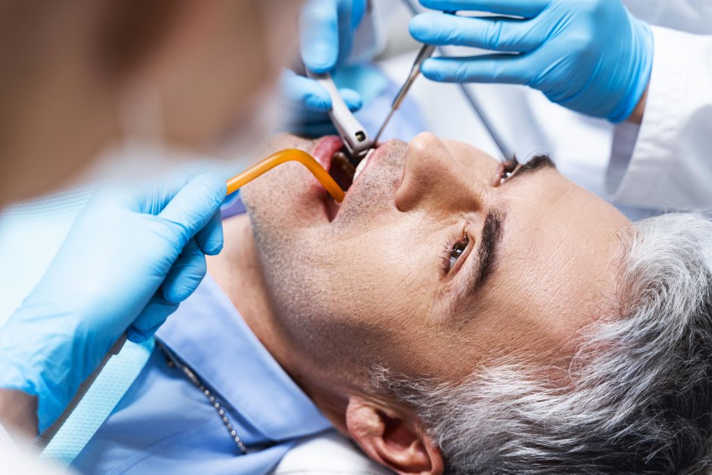 Wisdom Teeth Removal