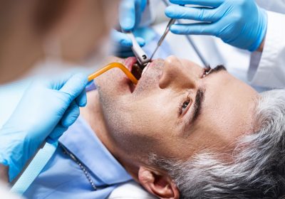 Wisdom Teeth Removal in Boduppal, Banjara Hills, Shaikpet, & Kukatpally